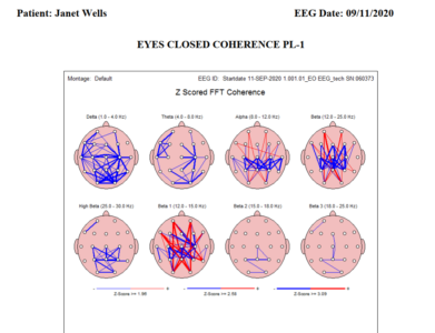Janet-brain-map-coherence-live-1.png