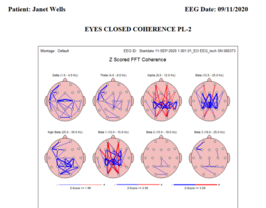 Janet-brain-map-coherence-live-2.png
